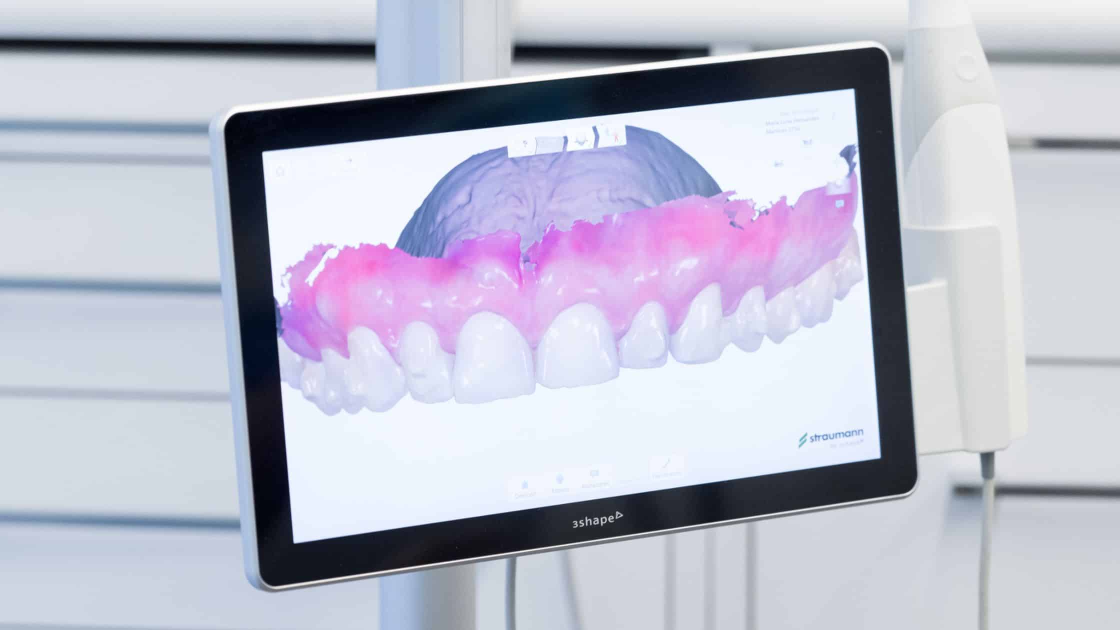 instalaciones Clinica dental Ruiz de gopegui
