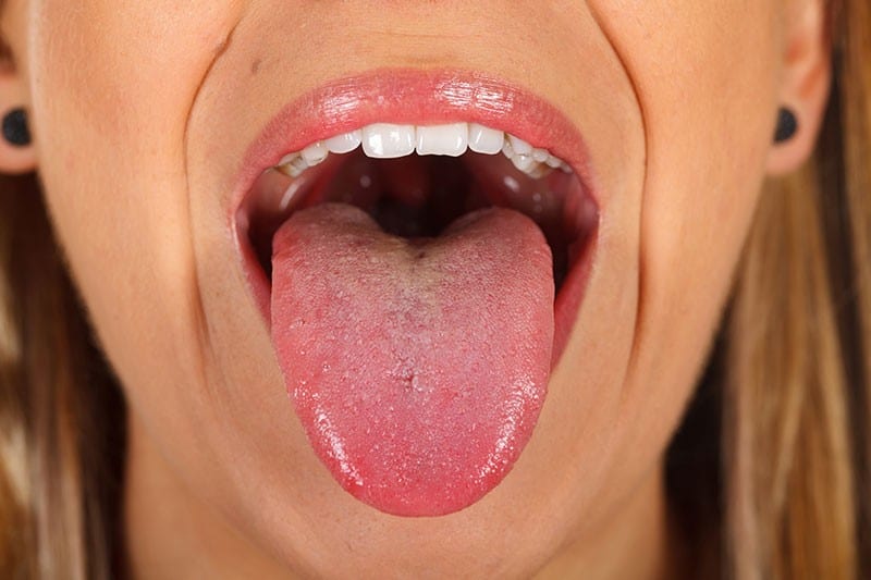 Higiene de la lengua