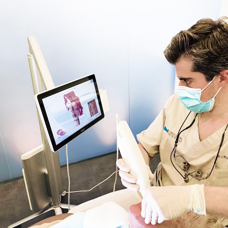 Escáner intraoral