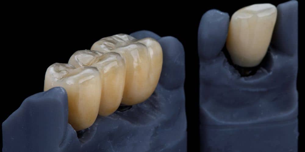 Biomateriales dentales
