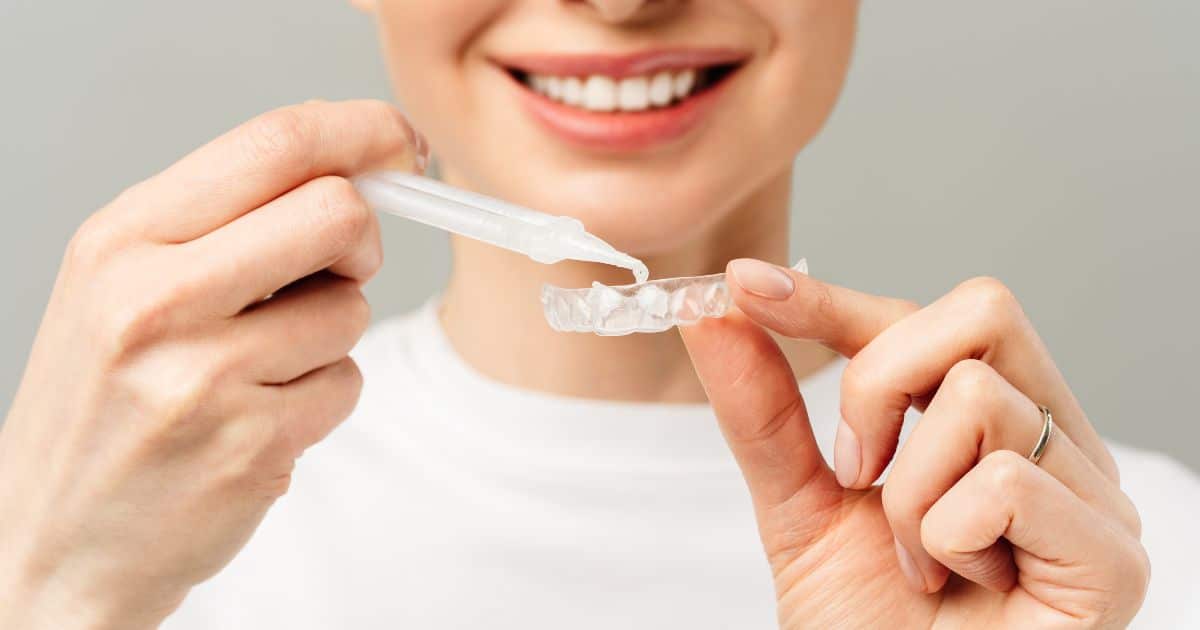 Blanquear los dientes