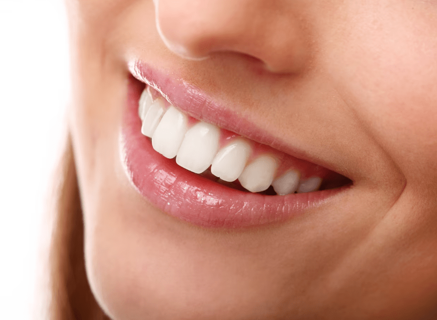 sonrisa acceledent clinica dental ruiz de gopegui