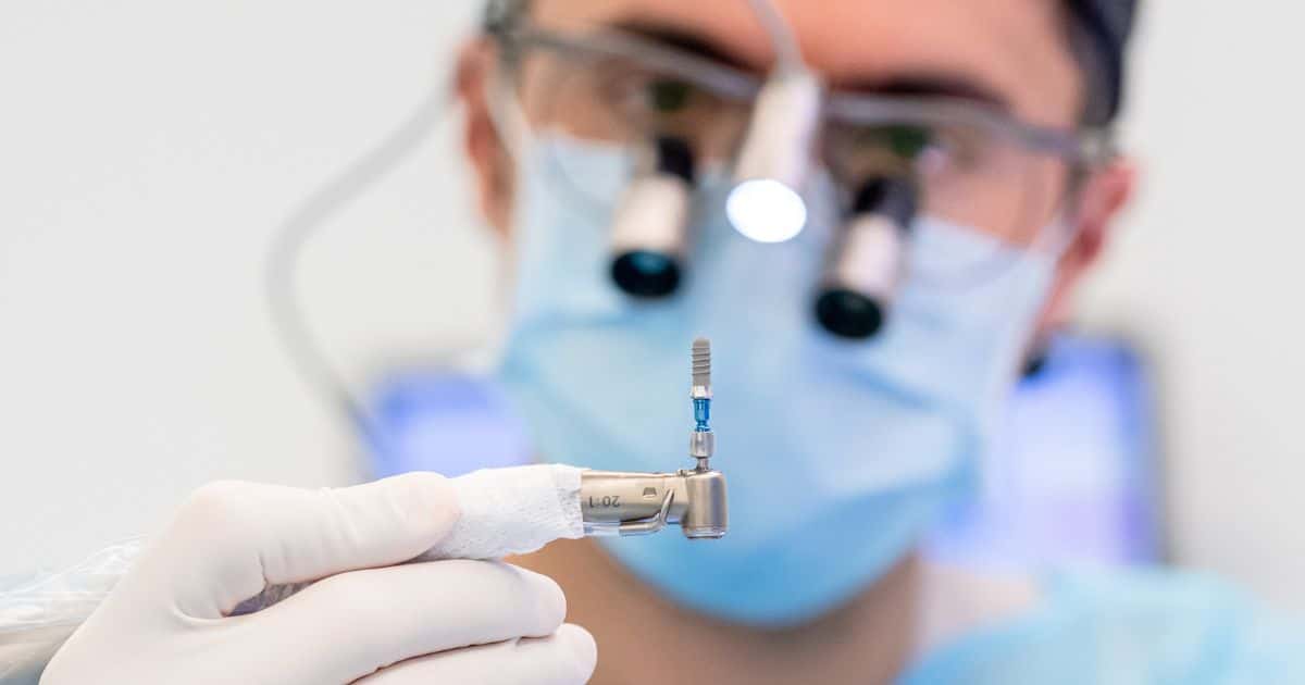 Cómo se colocan los implantes dentales
