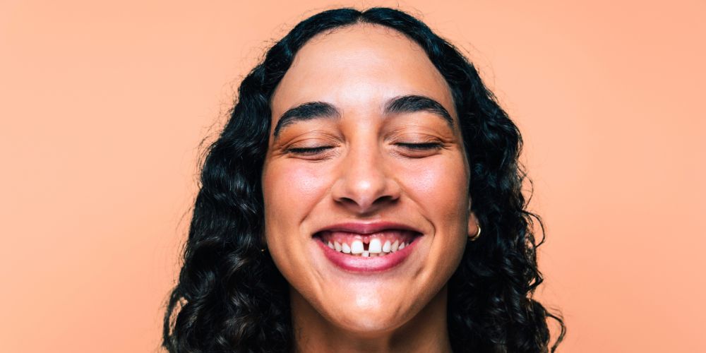 Diastema