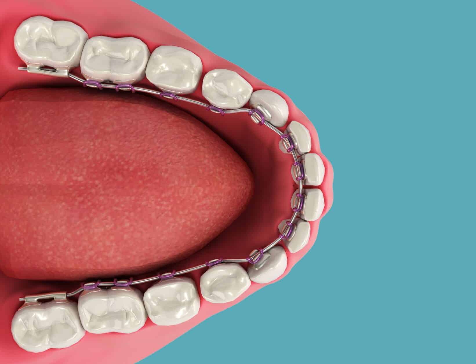 ilustracion lingual clinica dental ruiz de gopegui