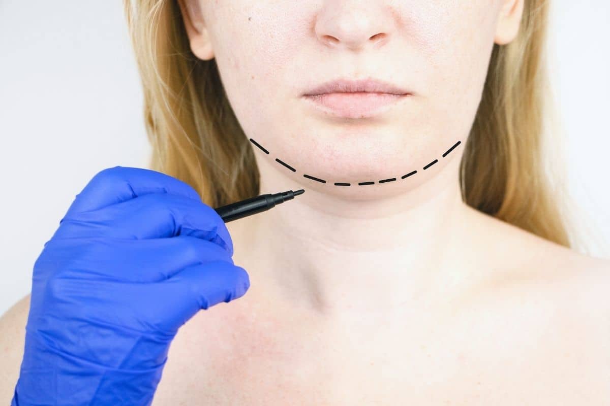 Mentoplastia - Clínica Dental Ruiz de Gopegui