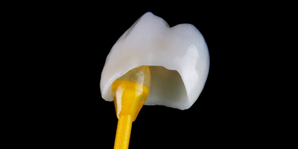 Fundas dentales