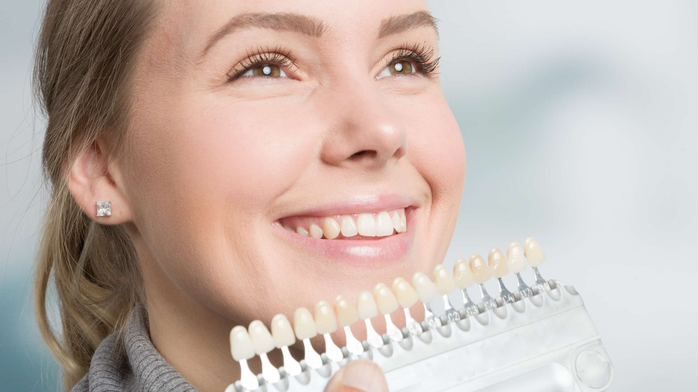 Carillas porcelana portfolio clinica dental ruiz de gopegui