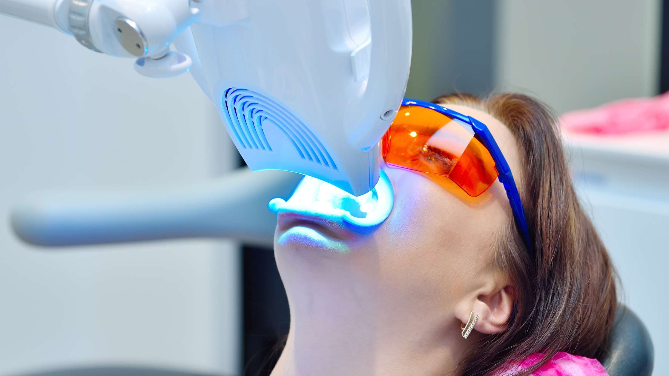 blanqueamiento laser clinica dental ruiz de gopegui