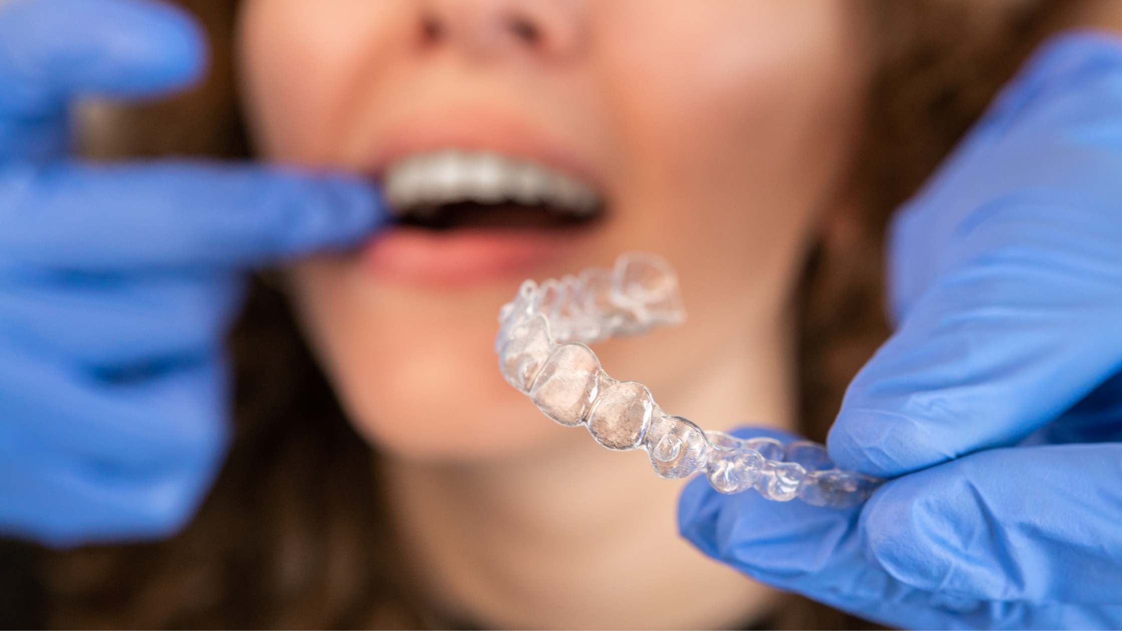 ortodoncia invisible para adultos invisalign clínica dental ruiz de gopegui