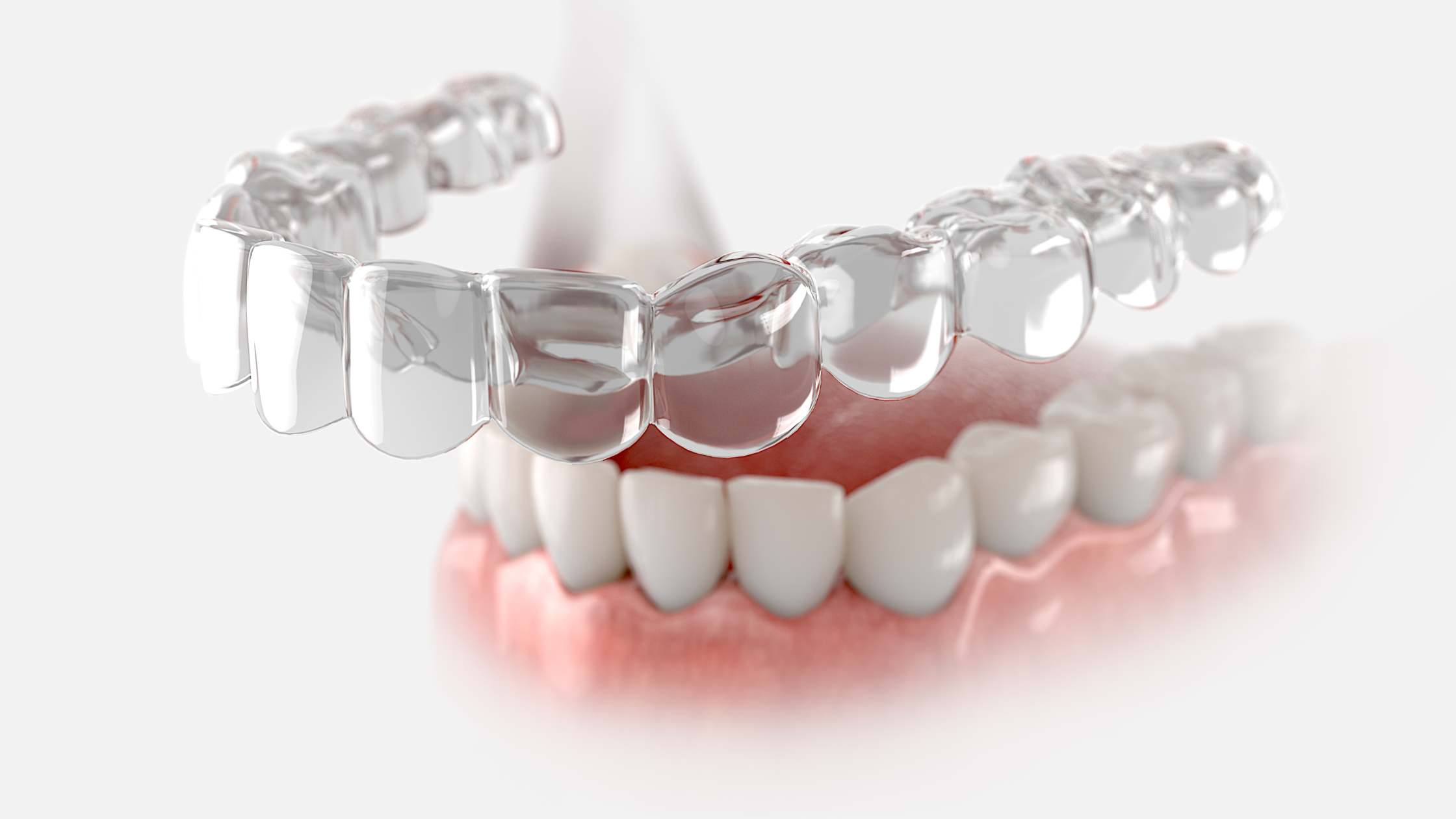 ortodoncia invisible para adultos invisalign clínica dental ruiz de gopegui
