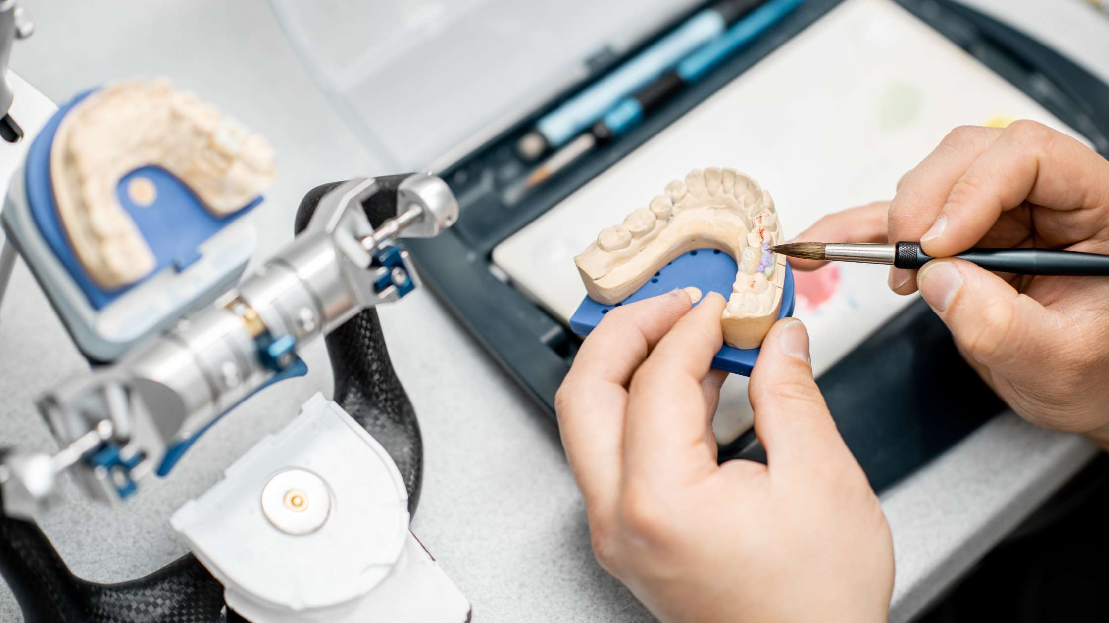 Prótesis fija clinica dental ruiz de gopegui