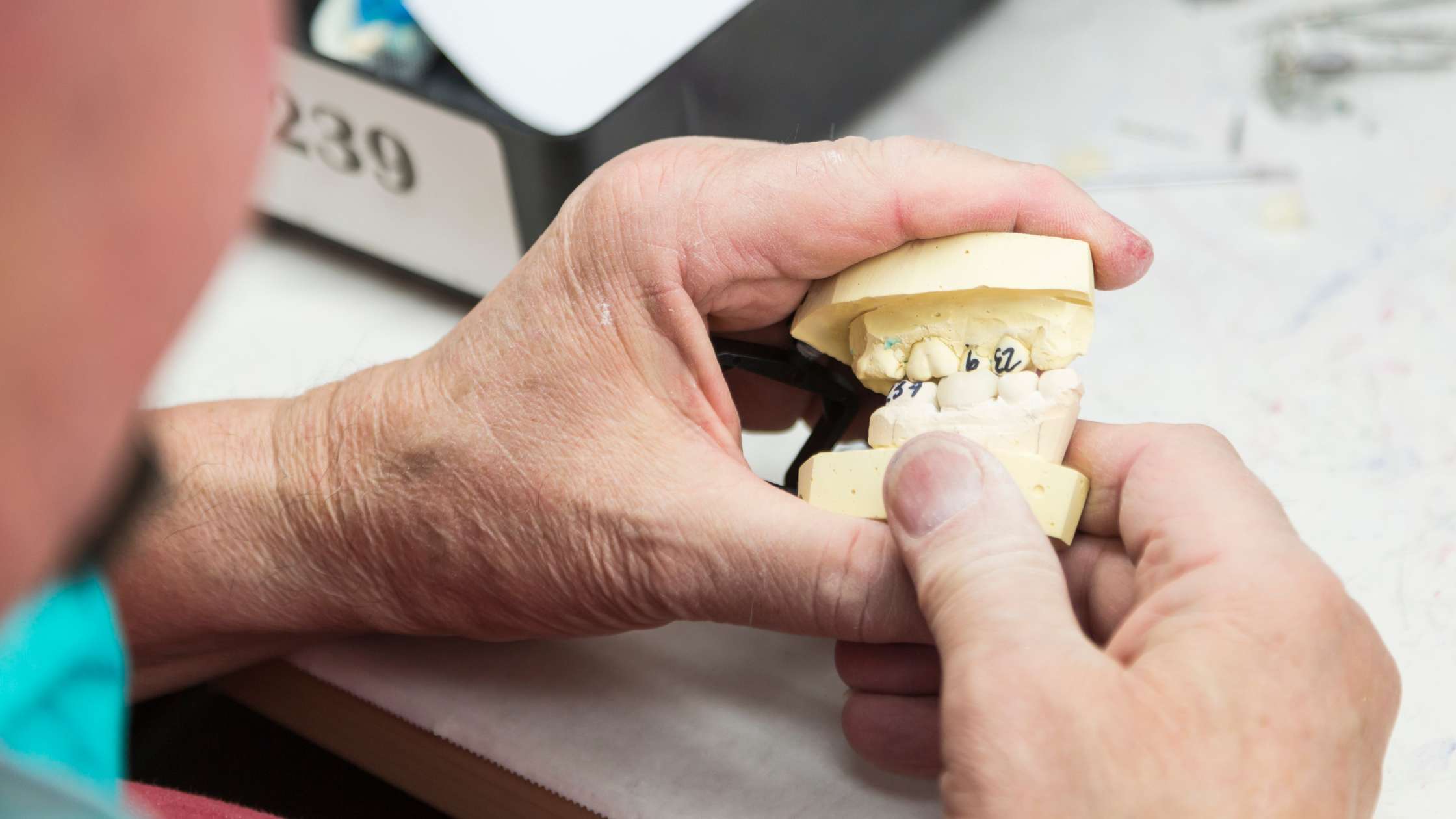 prótesis híbrida sobre implantes clinica dental ruiz de gopegui
