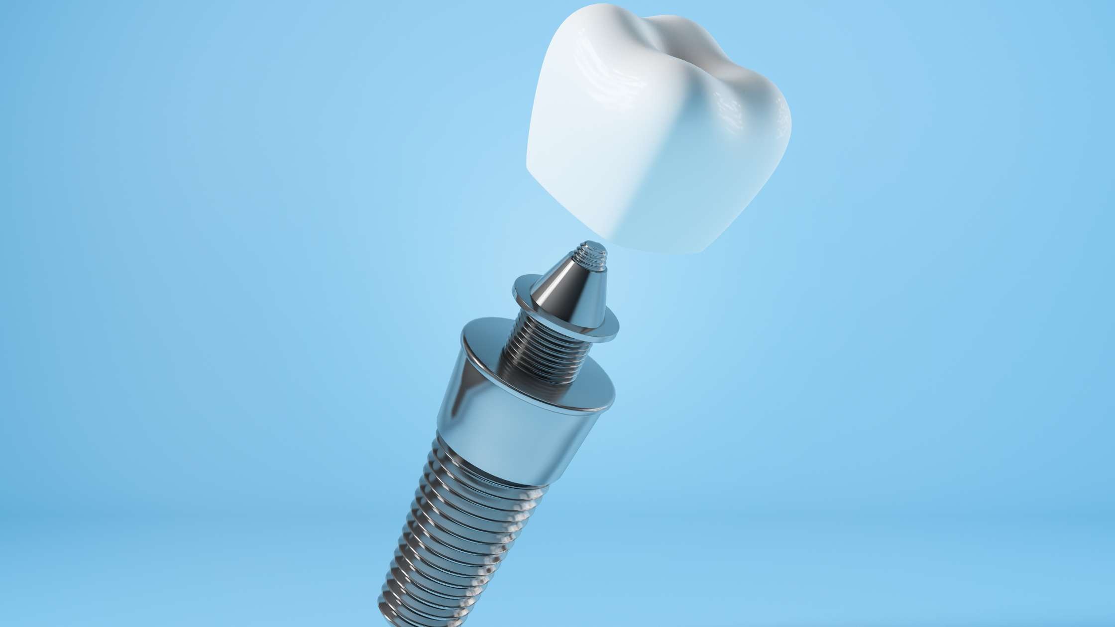 corona dental clinica dental ruiz de gopegui