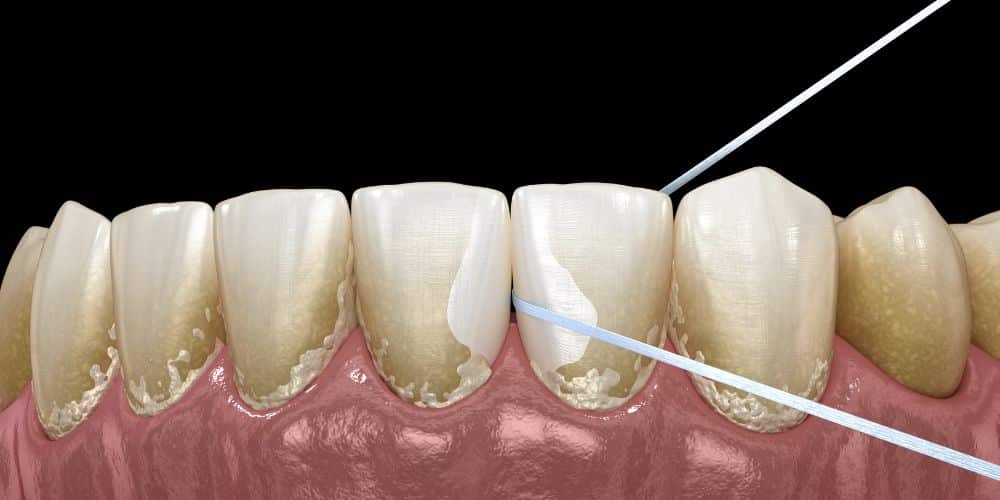 Hilo dental