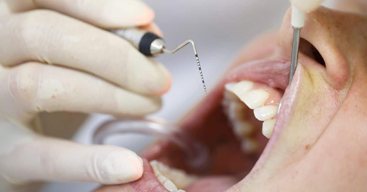 La enfermedad periodontal