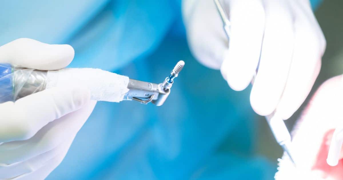 Los implantes dentales son perjudiciales para la salud