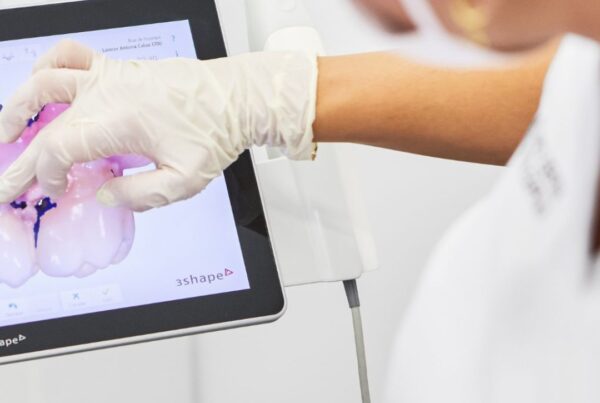 Mantenimiento de implantes dentales