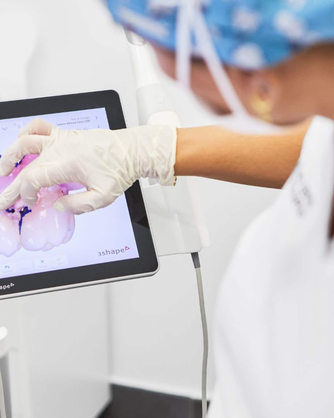 Mantenimiento de implantes dentales