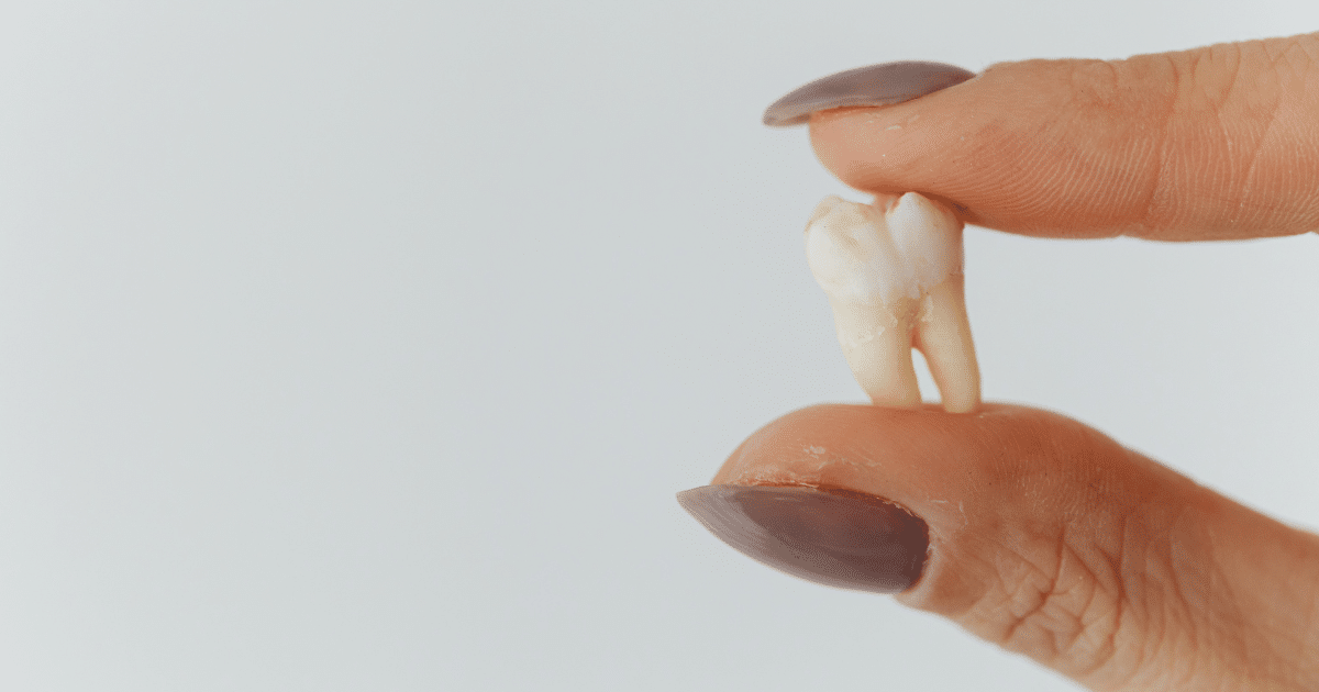 Prismas del esmalte
