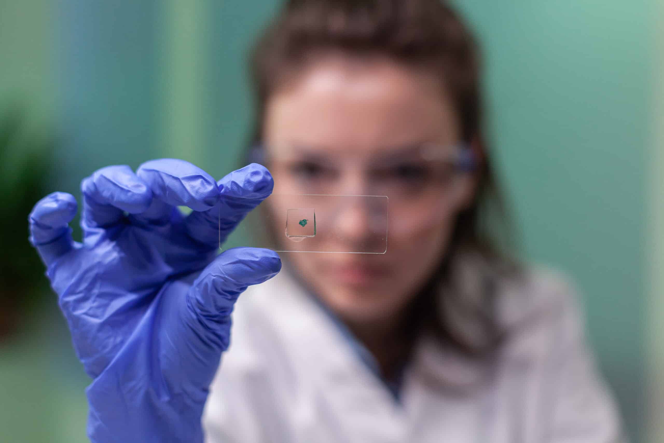 Test microbiológico periodontal análisis bacterias periodontales Madrid