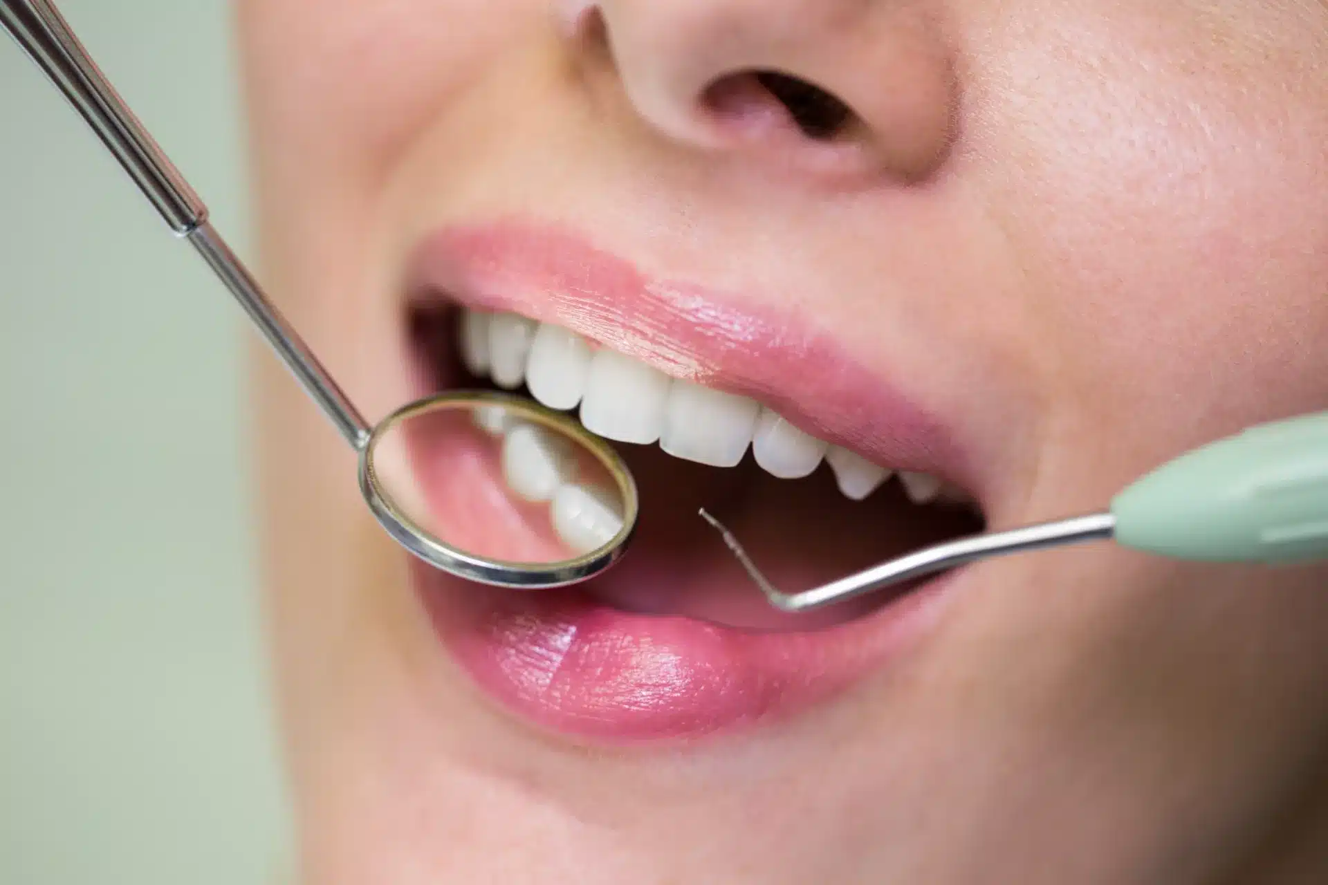 Cirugía plástica periodontal