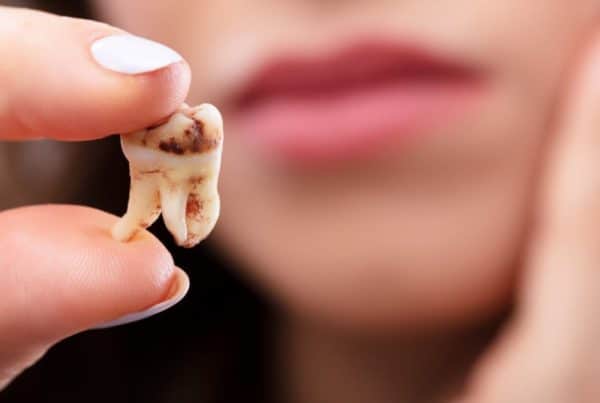 dientes flojos