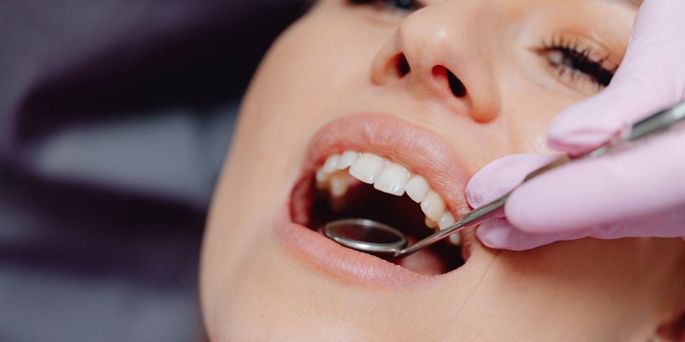 dientes transparentes o translúcidos