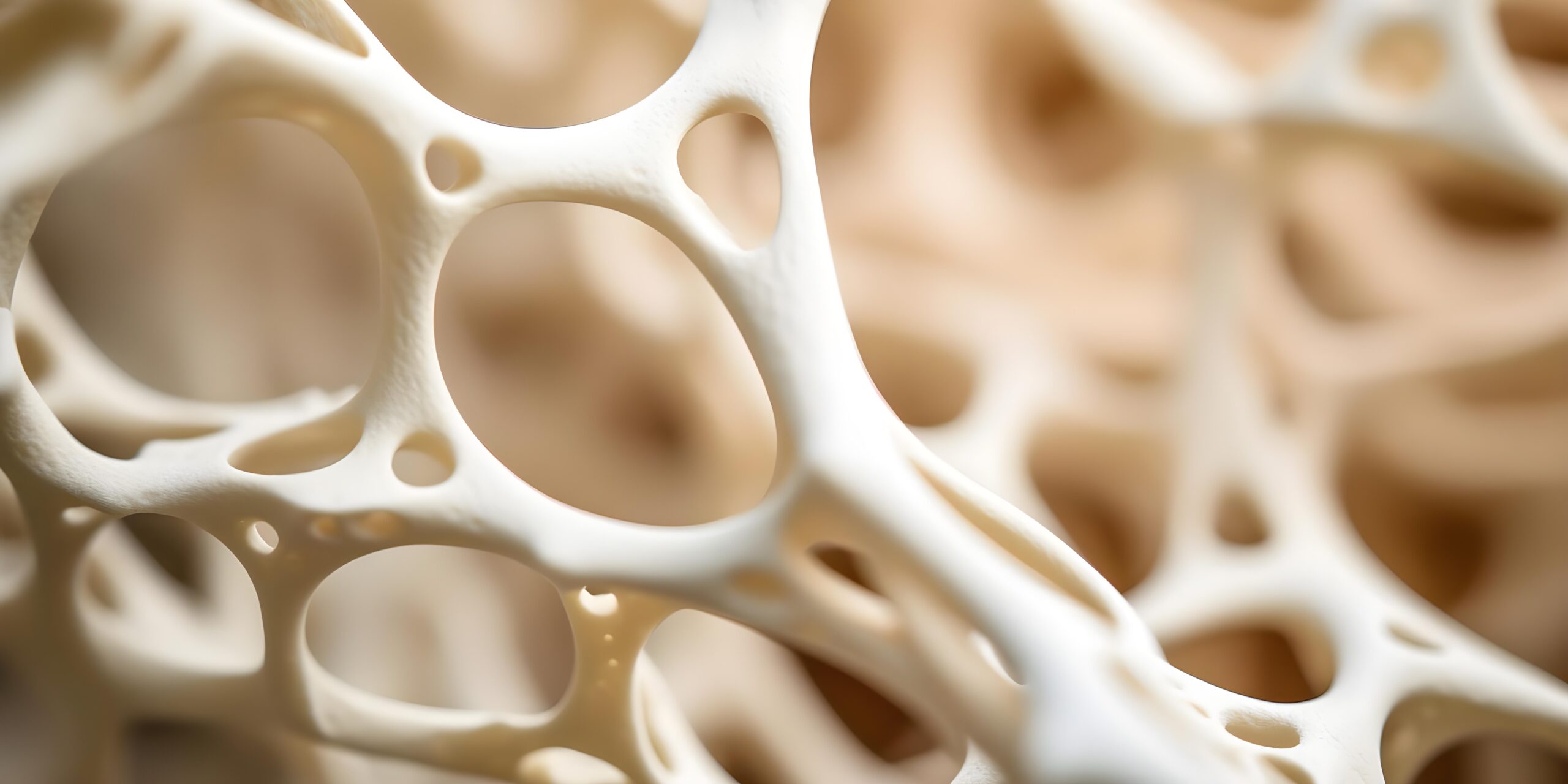 osteoporosis salud bucodental