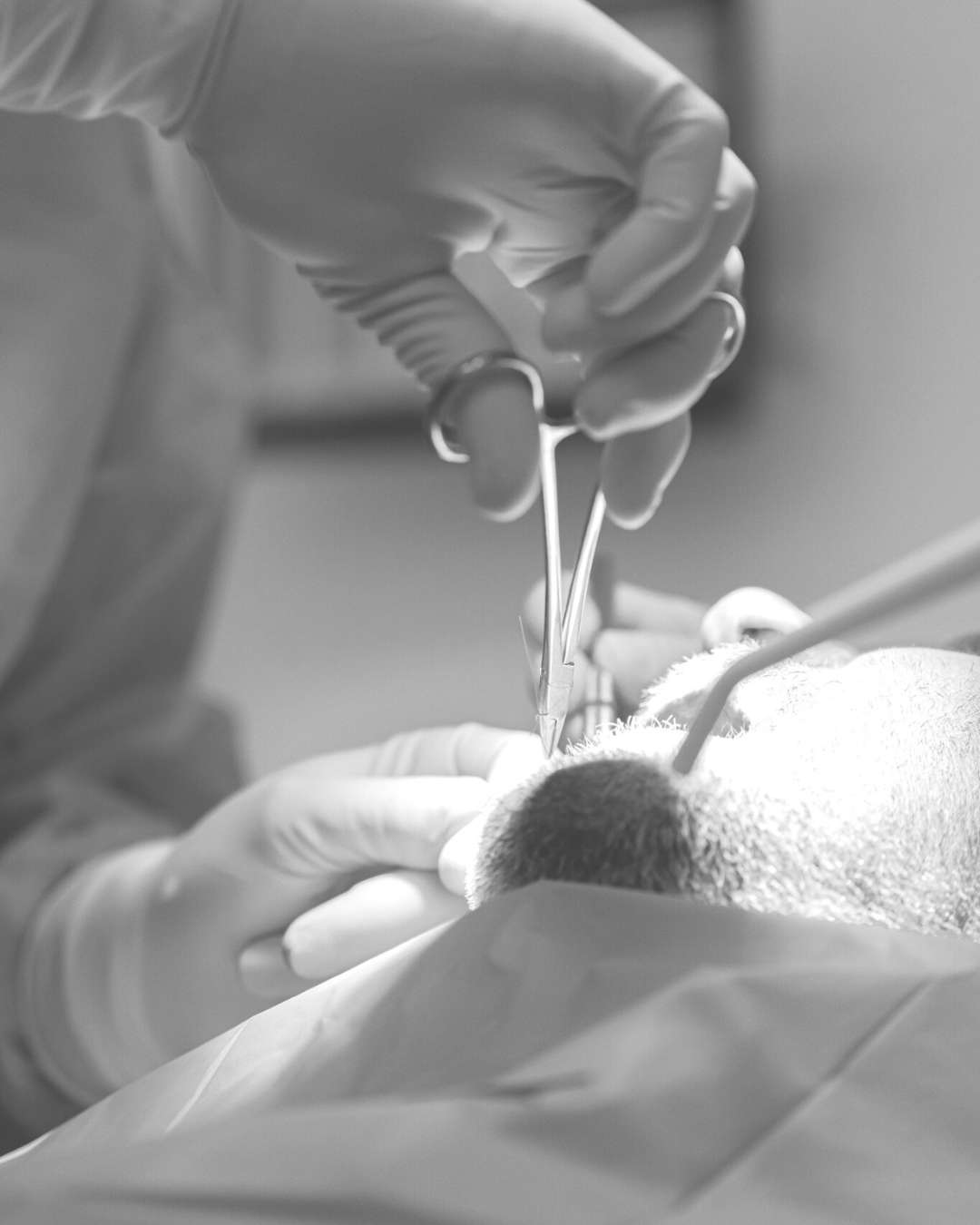 Exodoncia clinica dental ruiz de gopegui