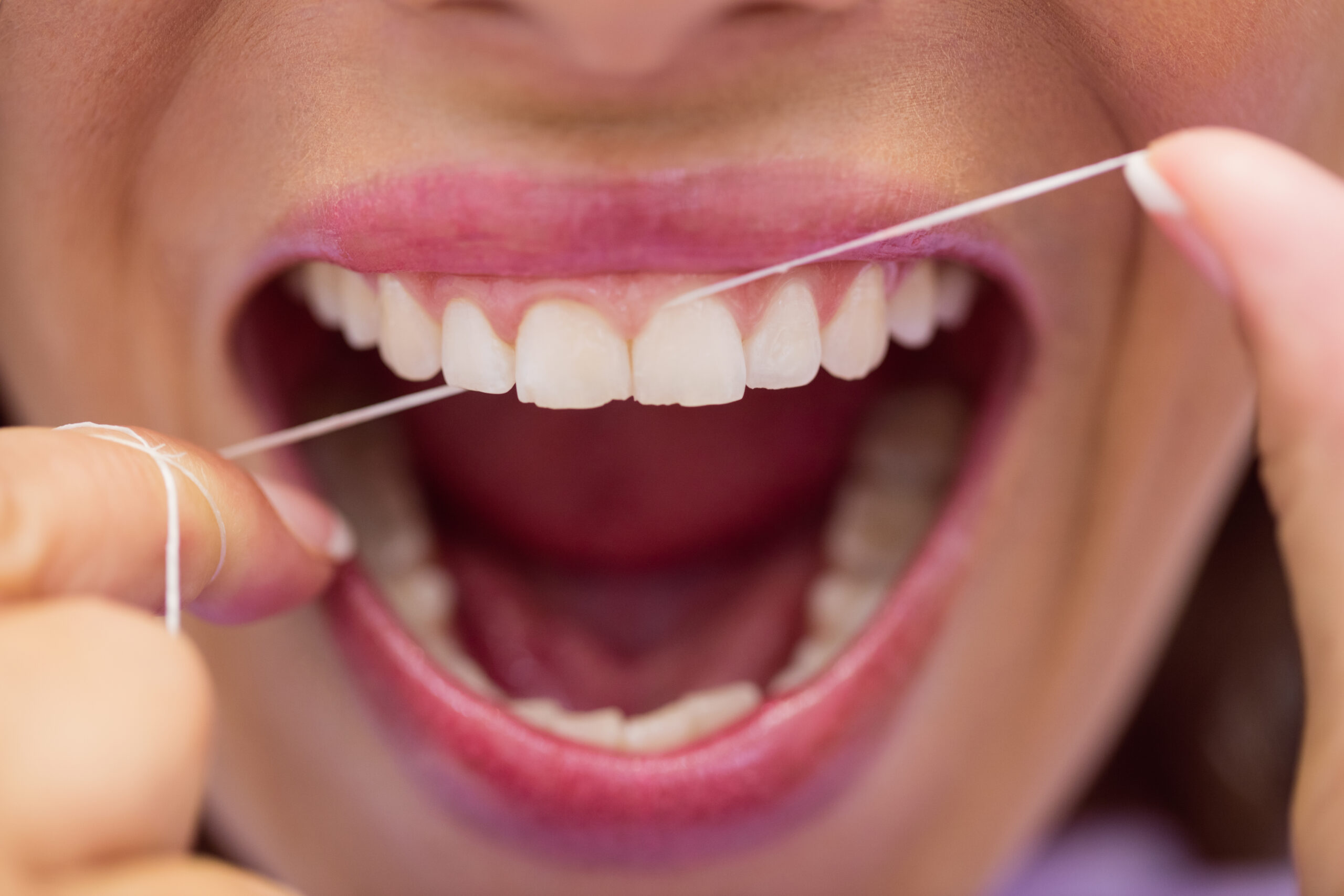 Stripping dental