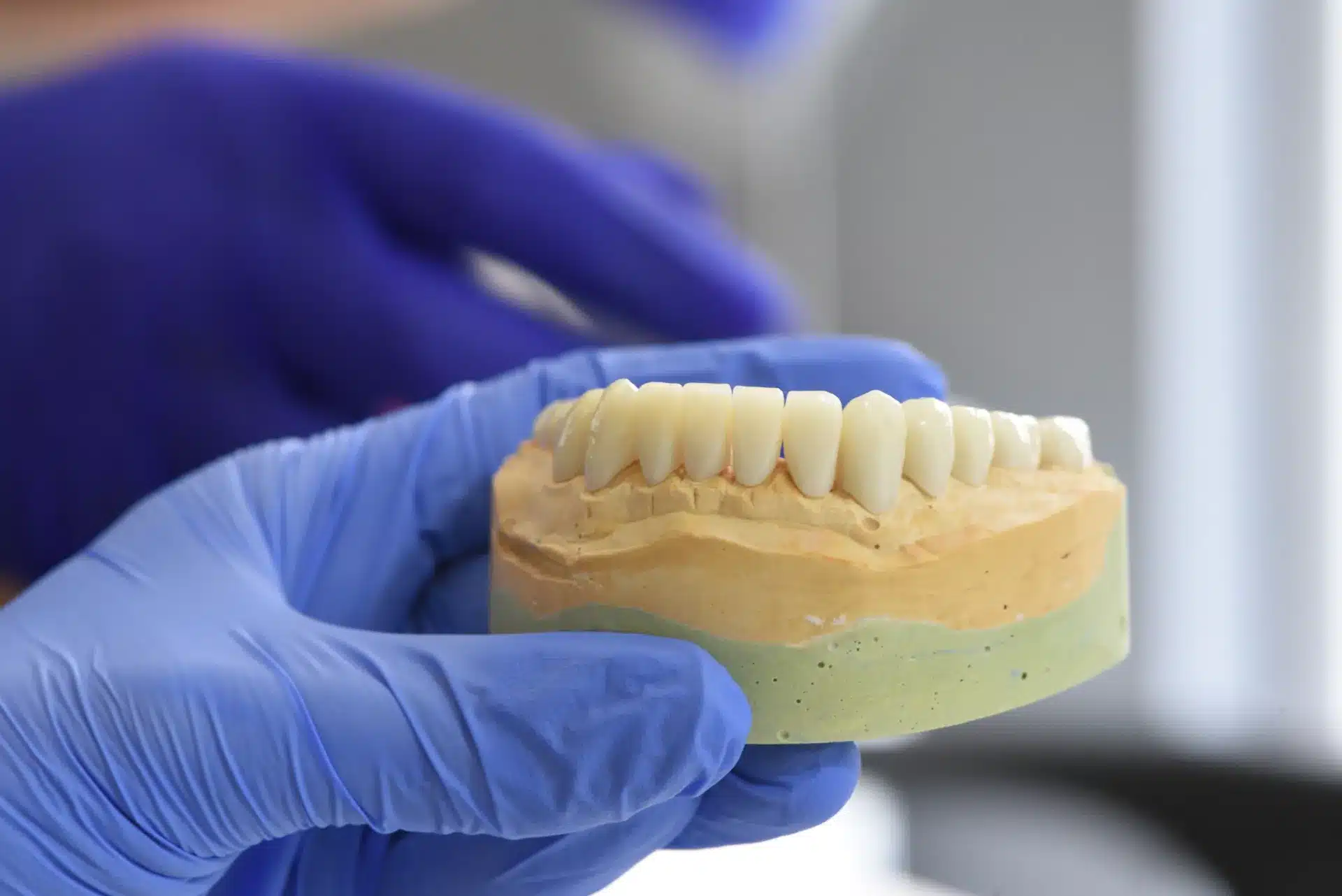 implantes dentales en mayores
