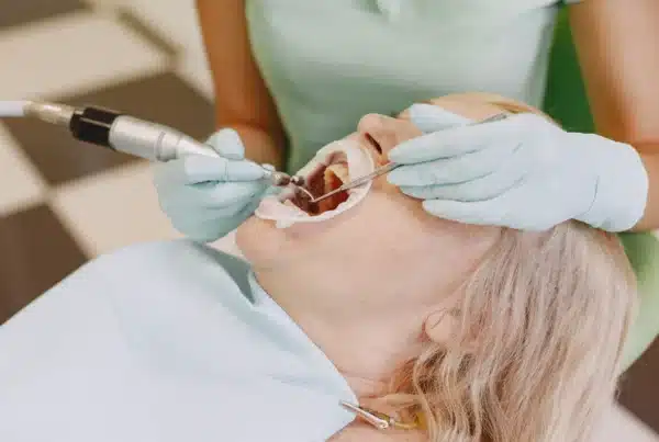 Limpieza dental o curetaje en Madrid: diferencias y cuándo se necesita cada uno - Clínica Ruiz de Gopegui limpieza dental o curetaje