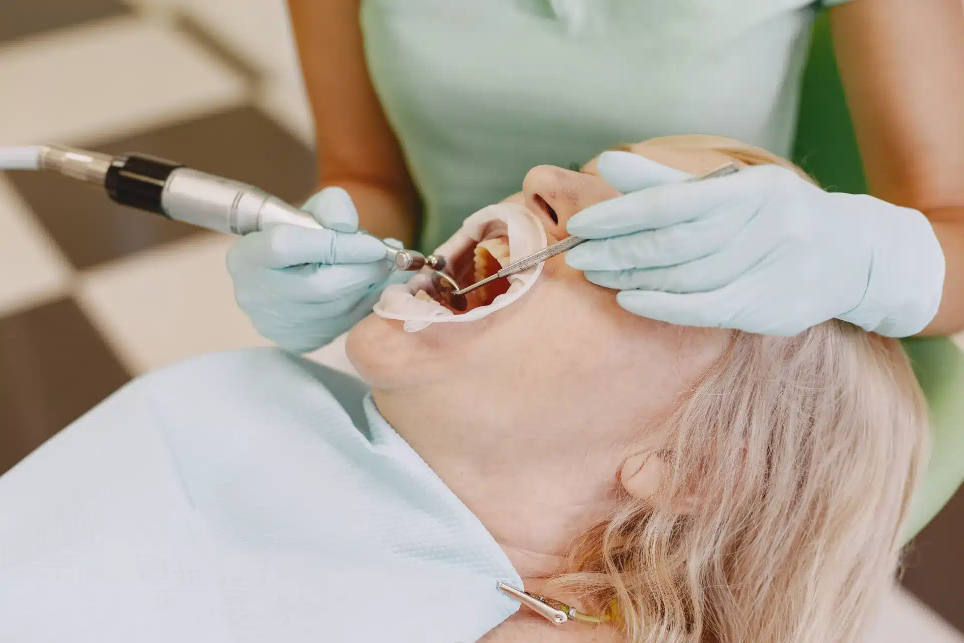 limpieza dental o curetaje