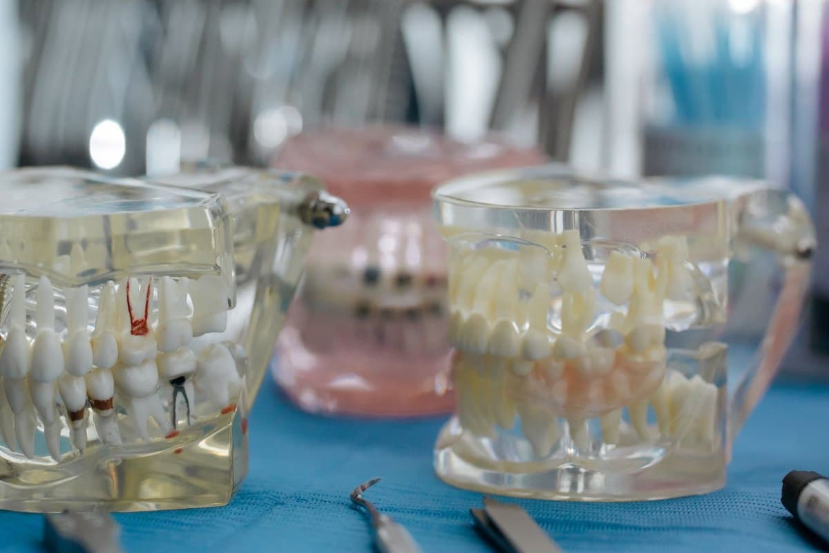 Modelos de dentaduras transparentes sobre una mesa de clínica, para explicar las prótesis dentales