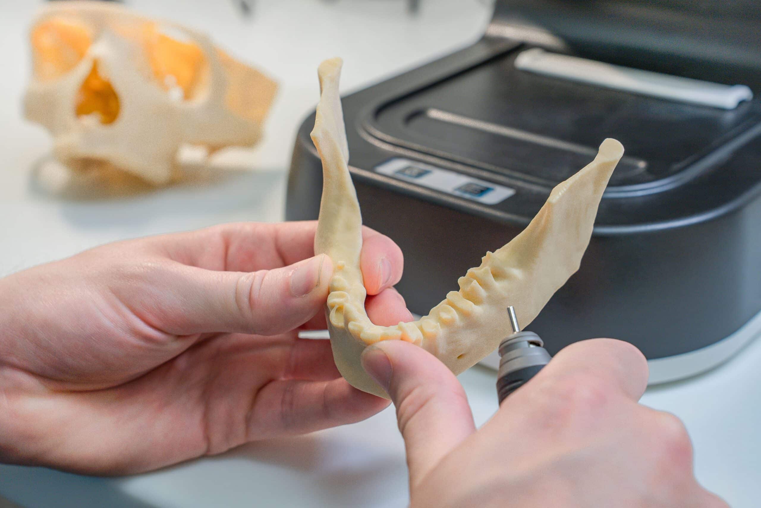 impresión 3d dental