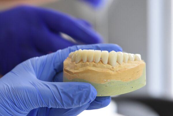dieta después de implantes dentales