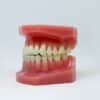 Apiñamiento dental