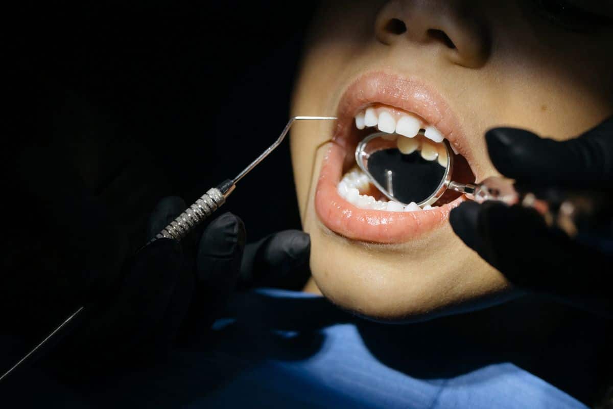 Niño en revisión dental por posible impacto de respiración oral