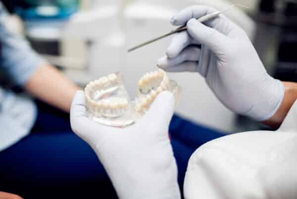 hábitos que dañan los implantes dentales