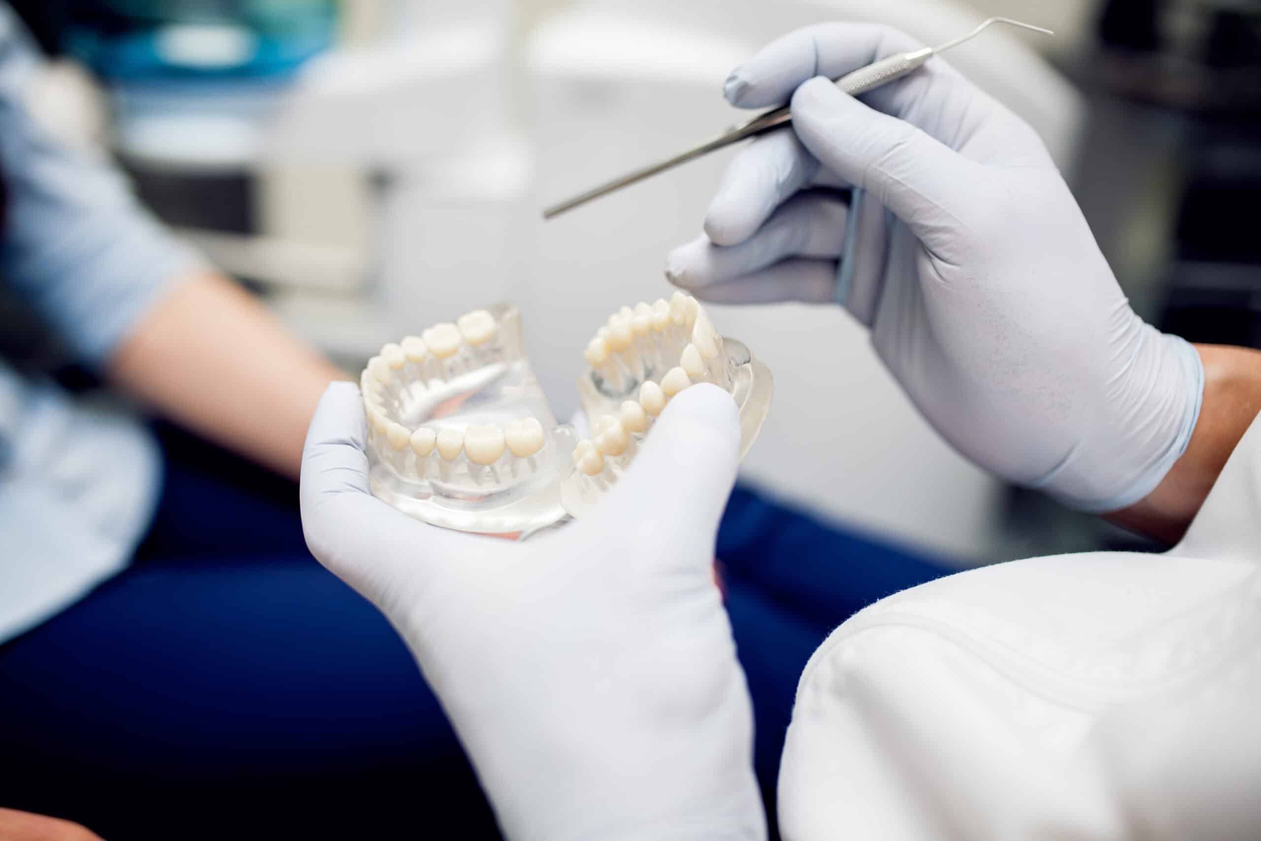 hábitos que dañan los implantes dentales