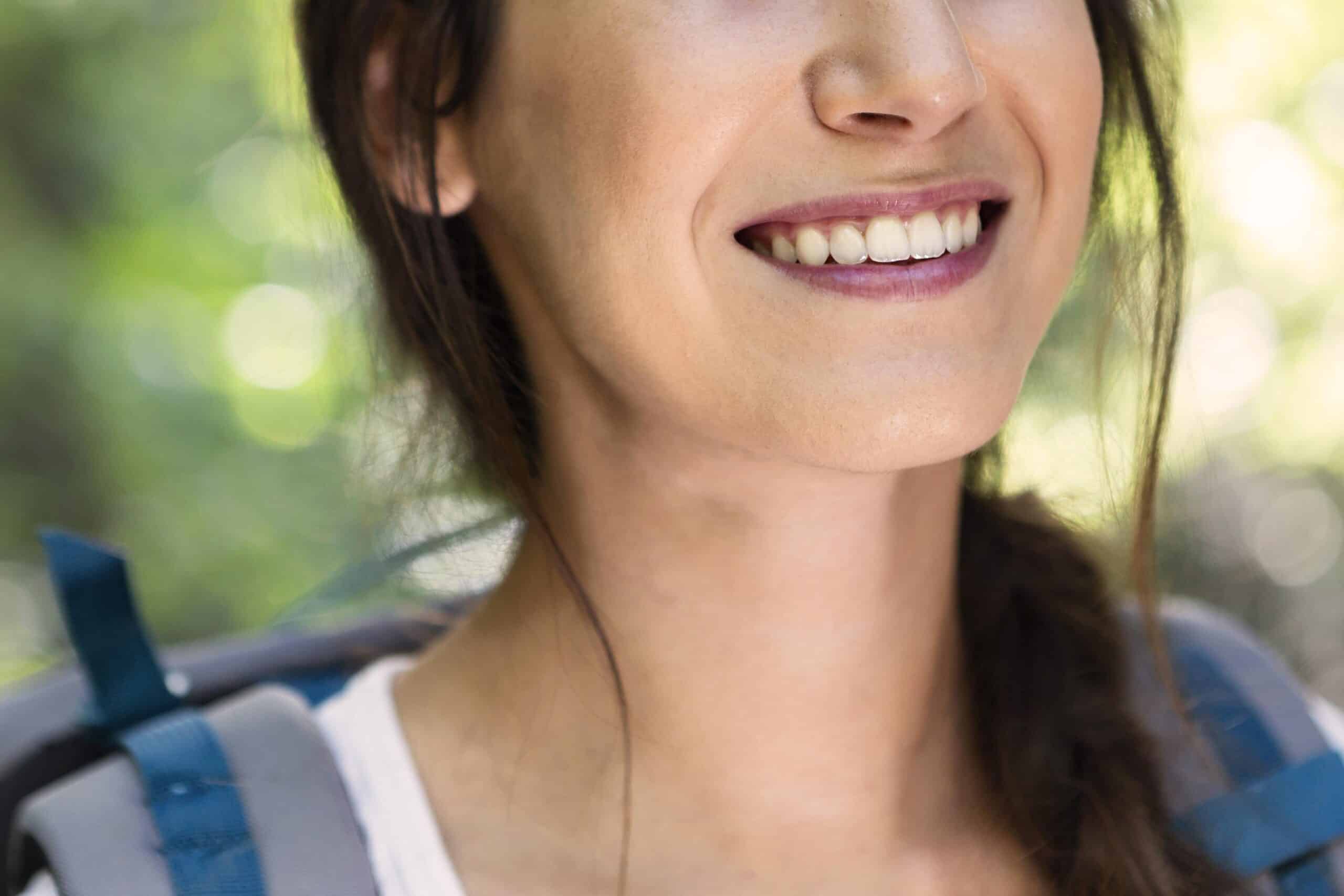 carillas dentales en un día