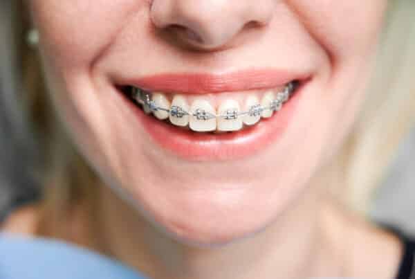 ortodoncia con implantes