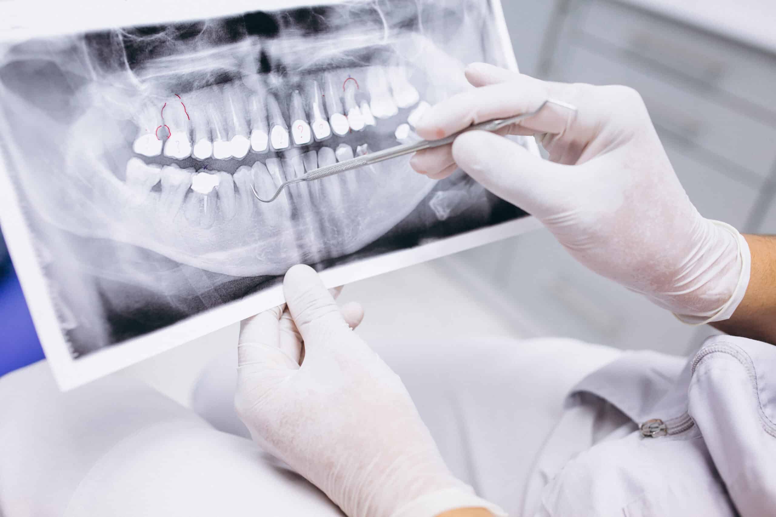 qué es un periodoncista
